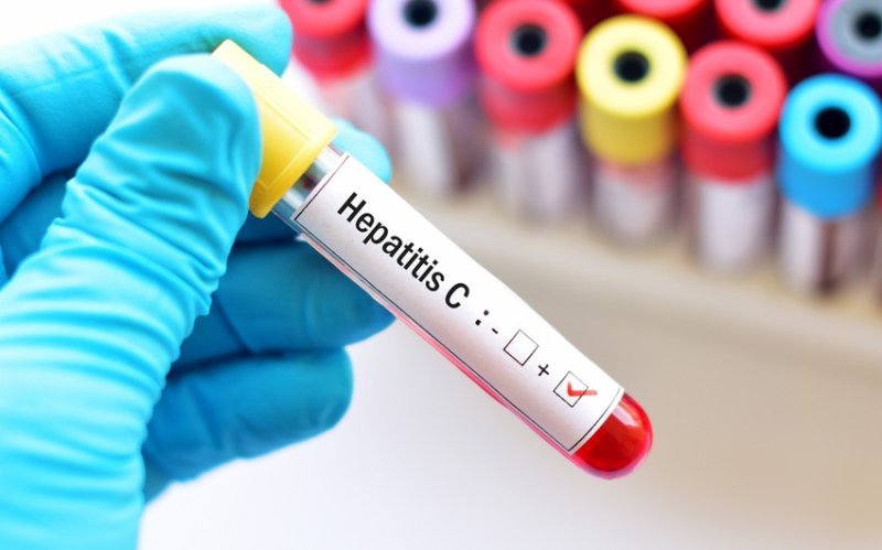 Azərbaycanda qeydiyyata alınan hepatit xəstələrinin sayı açıqlanıb