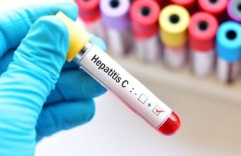 Azərbaycanda qeydiyyata alınan hepatit xəstələrinin sayı açıqlanıb