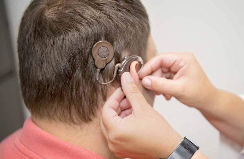 İlin ilk yarısında İTS hesabına koxlear implant əməliyyatı olunanların sayı açıqlanıb