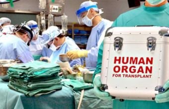 Ötən il Azərbaycanda 10-a yaxın meyitin orqanları başqasına köçürülüb