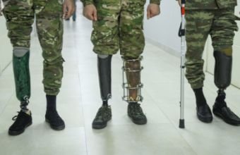 Vətən müharibəsi qazilərindən neçəsinə protez verilib?