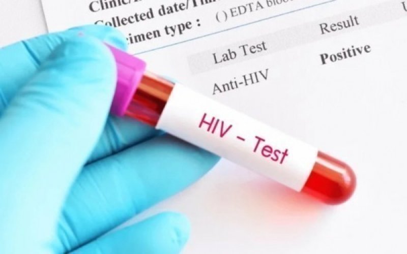 Azərbaycanda 38 il ərzində 11 mindən çox İİV xəstəsi olub