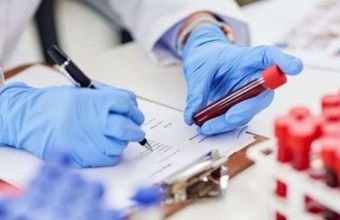 Dünyada koronavirus infeksiyasına yoluxanların sayı artıb