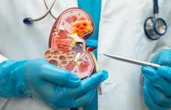 Son bir ildə Yeni Klinikada yeddi böyrək transplantasiyası həyata keçirilib