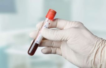 Qan donorları üçün güzəştlər...