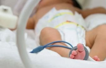 Ötən il Azərbaycanda 481 körpə ölü doğulub
